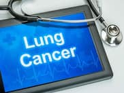 World Lung Cancer Day 2018: 3 things that you must know