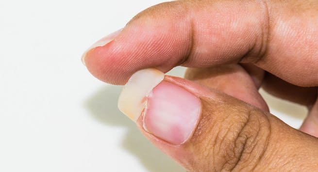 Do this to stop your fingernails from peeling 