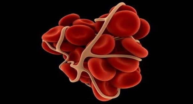 Is There Any Side-effect Of Blood Thinners? | TheHealthSite.com