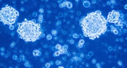 World Cerebral Palsy Day 2017: How stem cell therapy can help in treating cerebral palsy