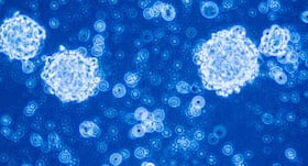 How stem cells can help to stay strong in old age How stem cells can help to stay strong in old age