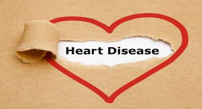 5 habits that can cause heart disease | TheHealthSite.com