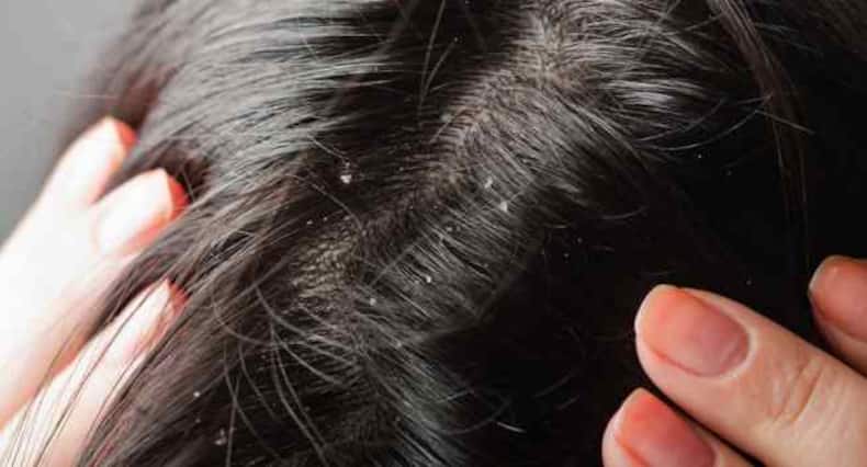5 ways to use jojoba oil for skin