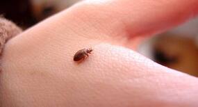 Bitten by a bed bug? Here’s what you should do