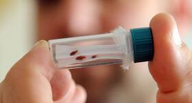 Bed bug facts that will make you start itching Bed bug facts that will make you start itching