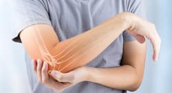 Know how to treat osteoporosis naturally