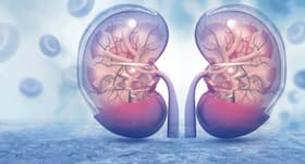 Diabetes and kidney disease: How high blood sugar wrecks the organs beyond repair