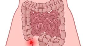 7 diet tips that boost healing after appendectomy 7 diet tips that boost healing after appendectomy