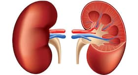 Did you know? Processed meat, carbonated beverages may lead to  kidney failure