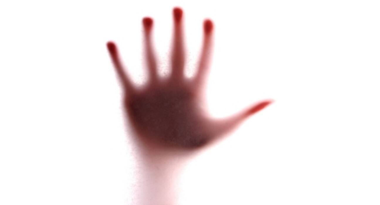 Halloween special - 9 medical conditions that are too spooky to be true