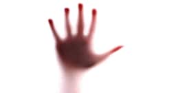 What is a phantom limb? Causes, symptoms and treatments