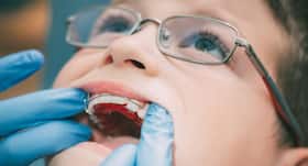 Does your child wear braces? Here are some diet tips to follow