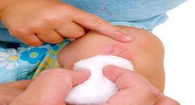 Want to heal your open wounds? Try these fool-proof hacks Want to heal your open wounds? Try these fool-proof hacks