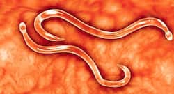 क्या आपके पेट में कीड़े हैं? आपको जरूर खानी चाहिए ये 4 चीजें