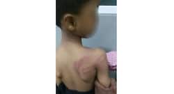 Hyderabad: Teacher arrested for caning 5-year-old