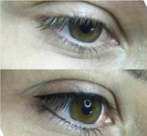 Eyes 1