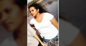 Before weight loss