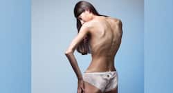 10 subtle signs that someone has an eating disorder