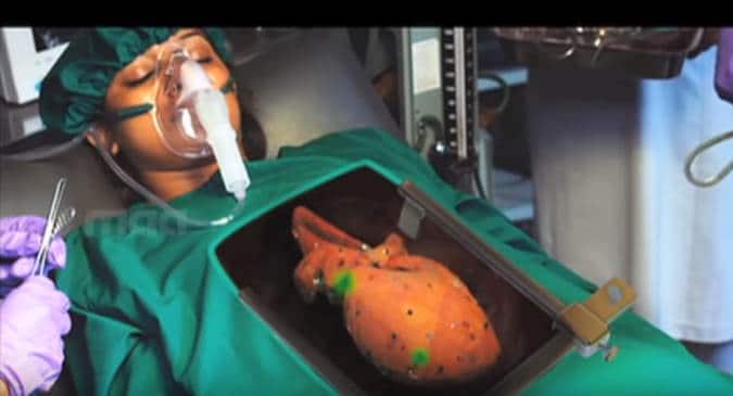 Bollywood movies that wrongly depicted organ donation on screen ...