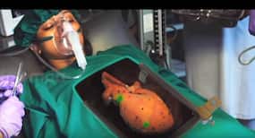 Bollywood movies that wrongly depicted organ donation on screen!