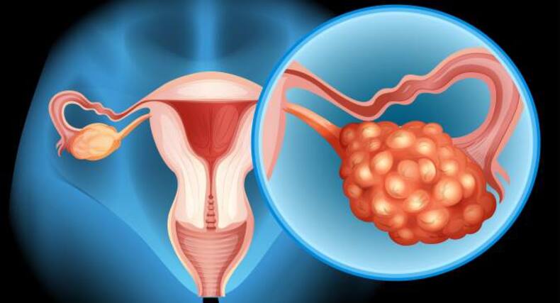6 possible causes of sudden weight gain that need attention right now