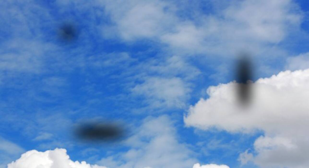 If you see these 7 diabetic eye symptoms, it's time to visit the doctor!