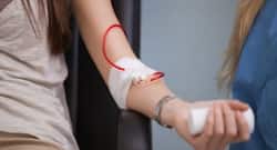 Blood stored for long may have adverse effects on patients with massive blood loss