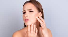 4 आजमाए हुए नुस्खे जो acne से दिलाते हैं राहत!