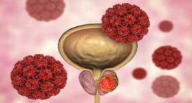 Cervical Cancer से 16 से 30 साल तक की महिलाओं को ज्यादा खतरा ! Cervical Cancer से 16 से 30 साल तक की महिलाओं को ज्यादा खतरा !