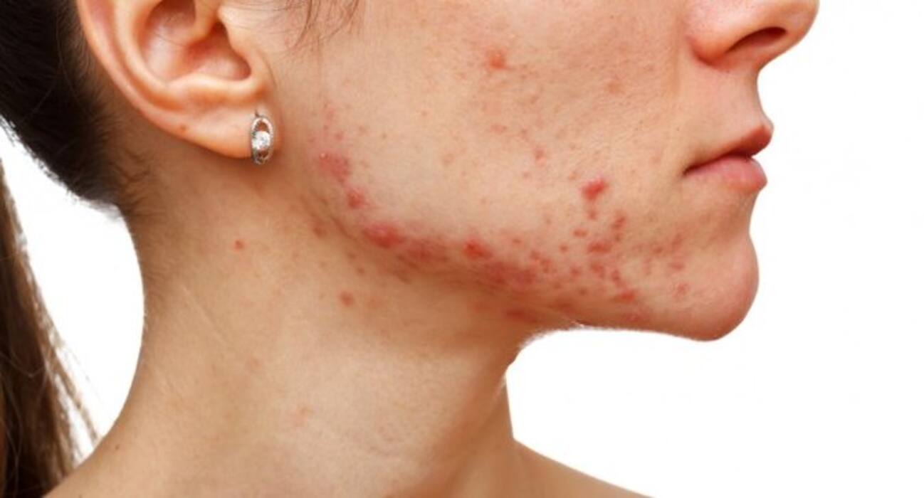 5 common causes of dark spots