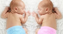 Conjoined twins Love and Prince separated in Mumbai