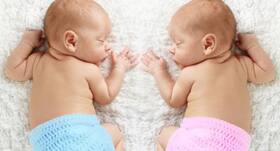 Conjoined twins Love and Prince separated in Mumbai