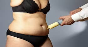 Can I get liposuction after c-section?