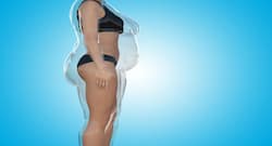 Planning to lose weight with liposuction? Read this!