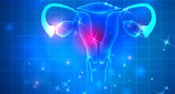 Fenugreek, fennel and flaxseeds – how they help to deal with PCOS?