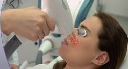 Laser resurfacing -- 4 reasons to try this new skin procedure