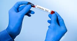 Blood tests for arthritis -- what you need to know