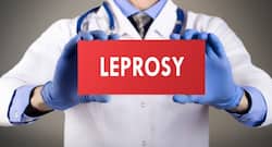 How is leprosy treated?