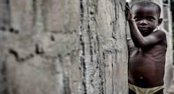 Shocking! 34% of children in UP malnourished