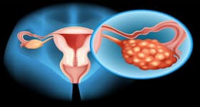 Doctors remove 132-pound ovarian tumour from woman