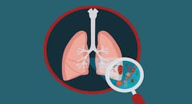 4 nutrients that can help prevent pneumonia