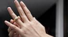 Here's how you can cure a wedding-ring itch