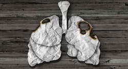 Study provides insight into development of lung cancer