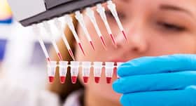 What is stem cell therapy for multiple sclerosis? What is stem cell therapy for multiple sclerosis?