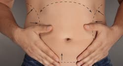 What to expect after a liposuction or fat reduction surgery