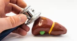 Gastroenterologist busts 5 myths about liver diseases