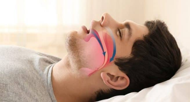 sleep-apnea-in-hindi