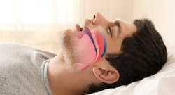 Sleep Apnea: होमियोपैथी में छिपा है स्लीप एप्निया का आसान और कारगर इलाज