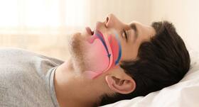 Sleep apnea may lead to lung cancer at young age, finds study