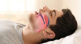 Floppy eyelids may be an indication of sleep apnoea